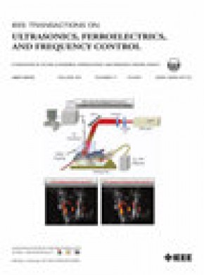Ieee Transactions On Ultrasonics Ferroelectrics And Frequency Control雜志