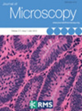 Journal Of Microscopy雜志