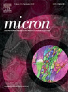 Micron雜志